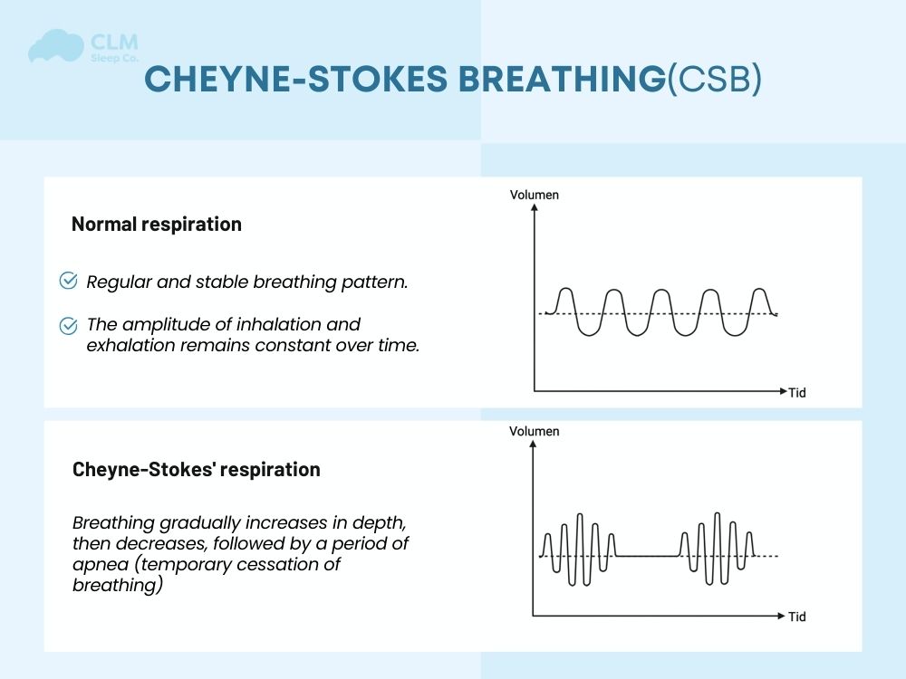 Normal vs. Cheyne-Stokes Respiration