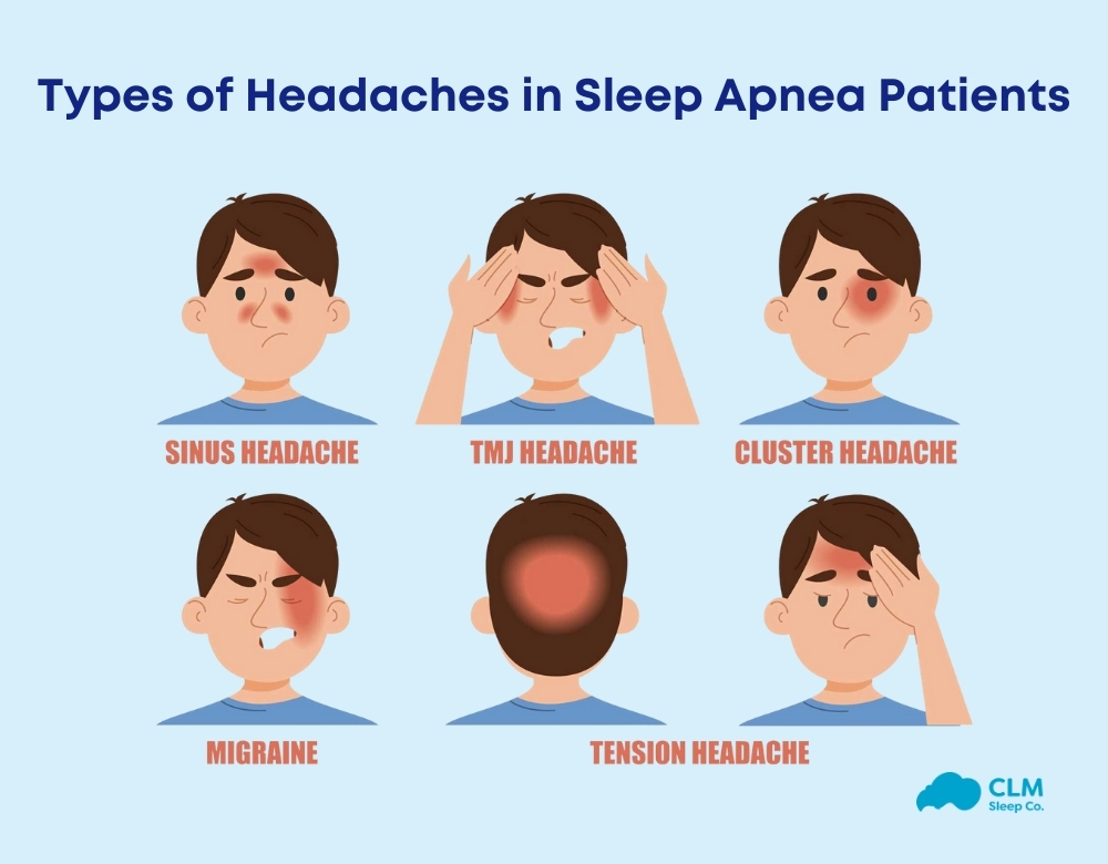 Common types of headaches in sleep apnea patients
