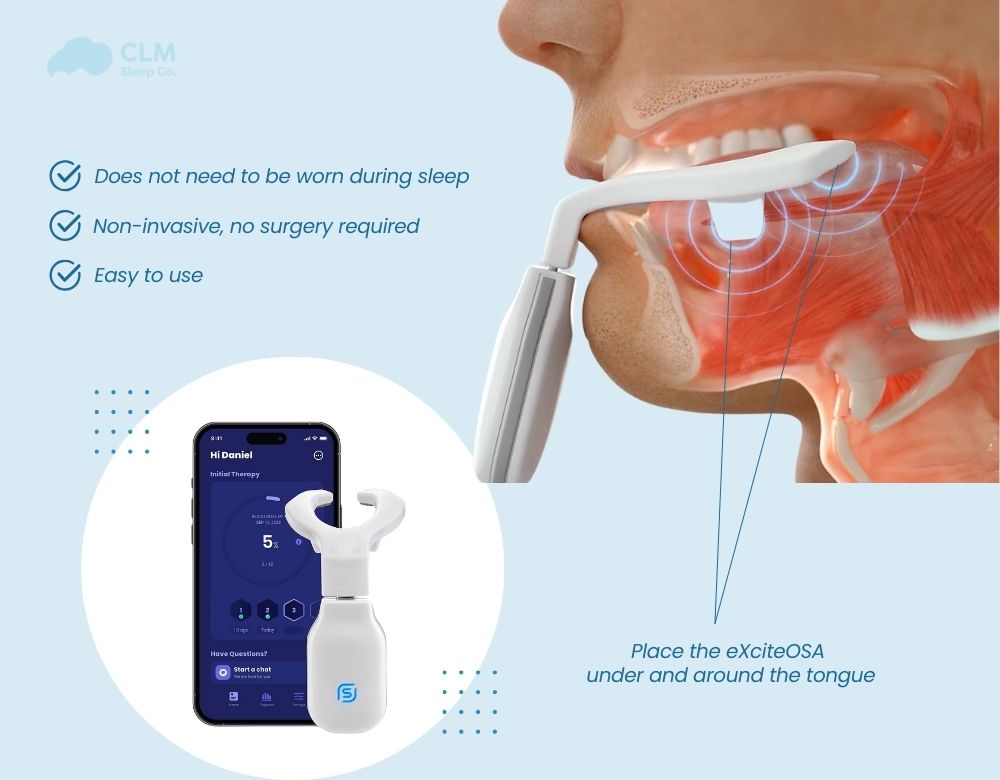 eXciteOSA for sleep apnea