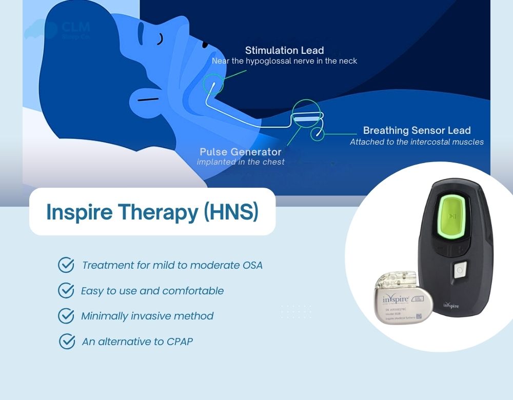 Inspire Therapy for sleep apnea